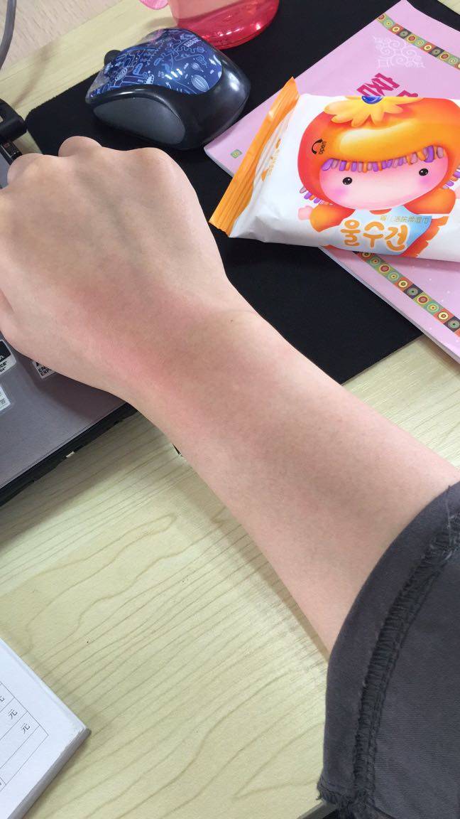 浑身刺挠 白天坐立不安 晚上睡不好觉 一抓就是红印子 这两天下雨 好