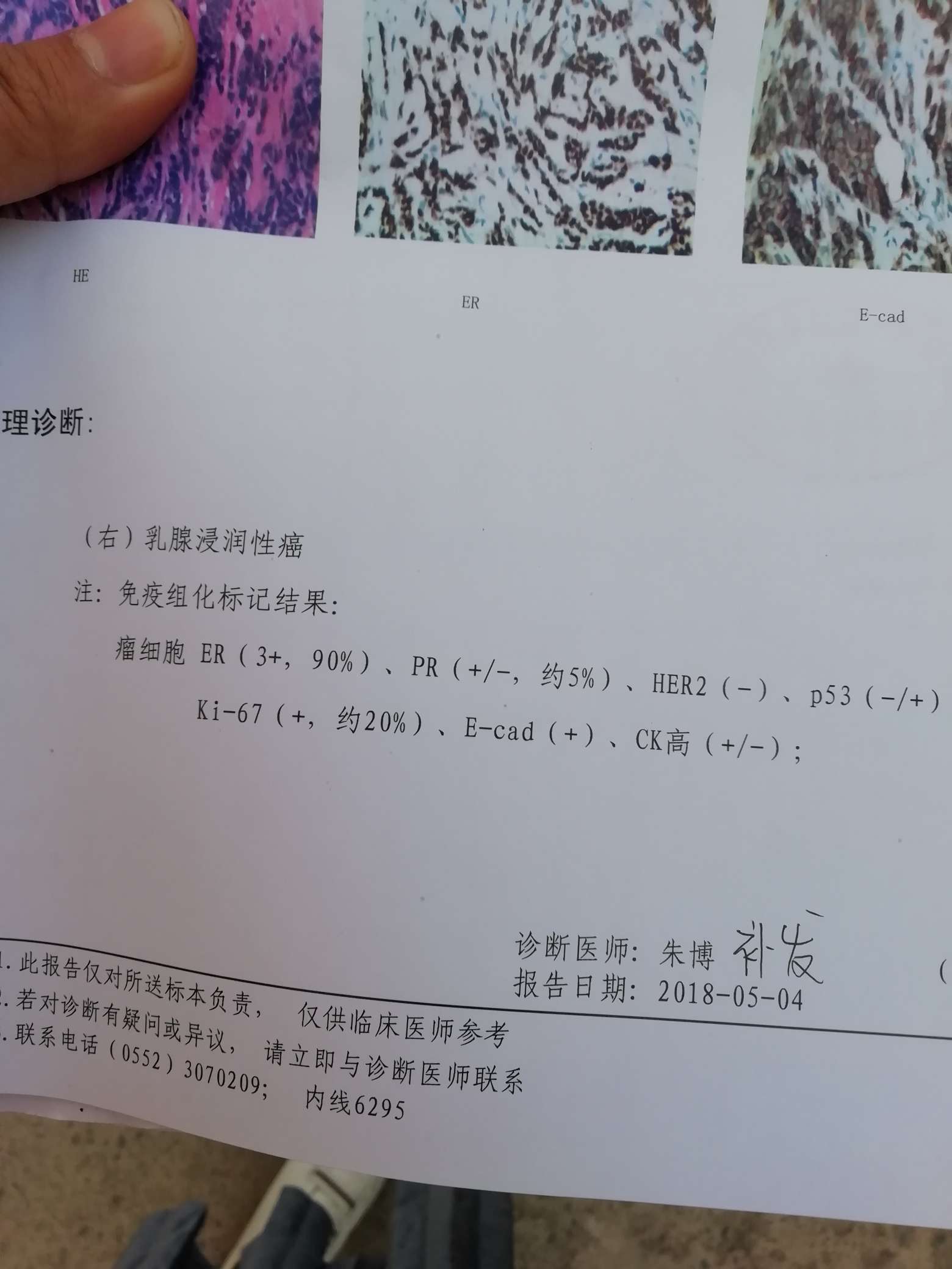 妈妈的免疫组化终于找到了