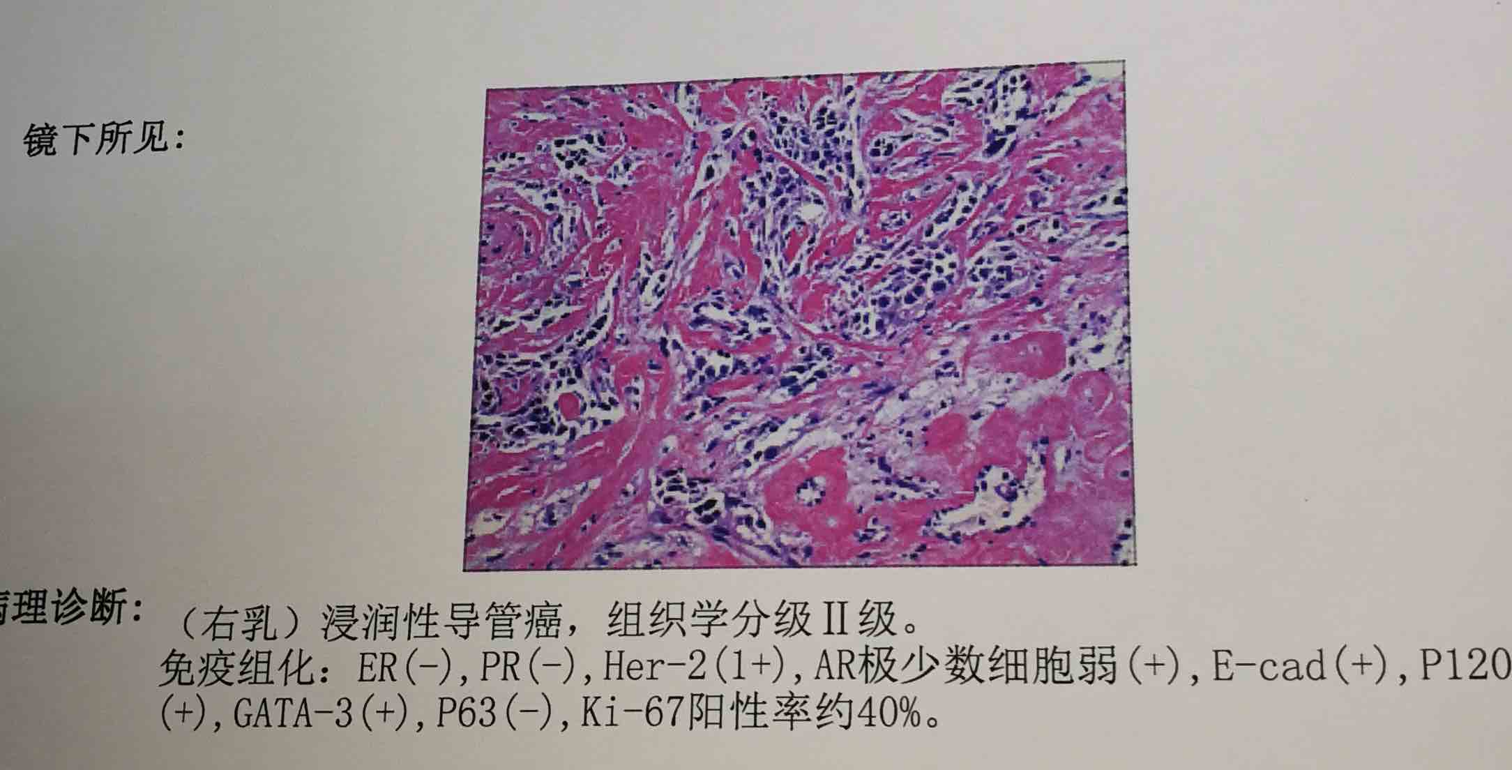 乳腺癌康复圈-觅健