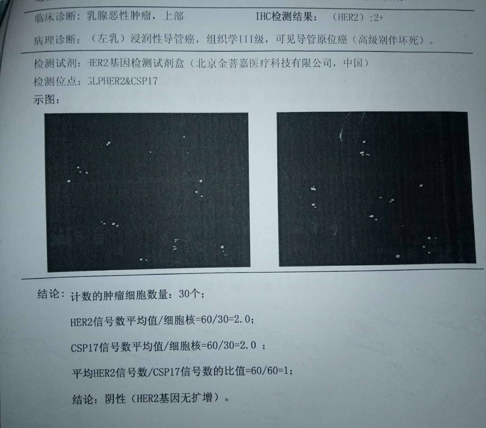 姐妹們幫我看看病理報告吧-乳腺癌康復圈-覓健