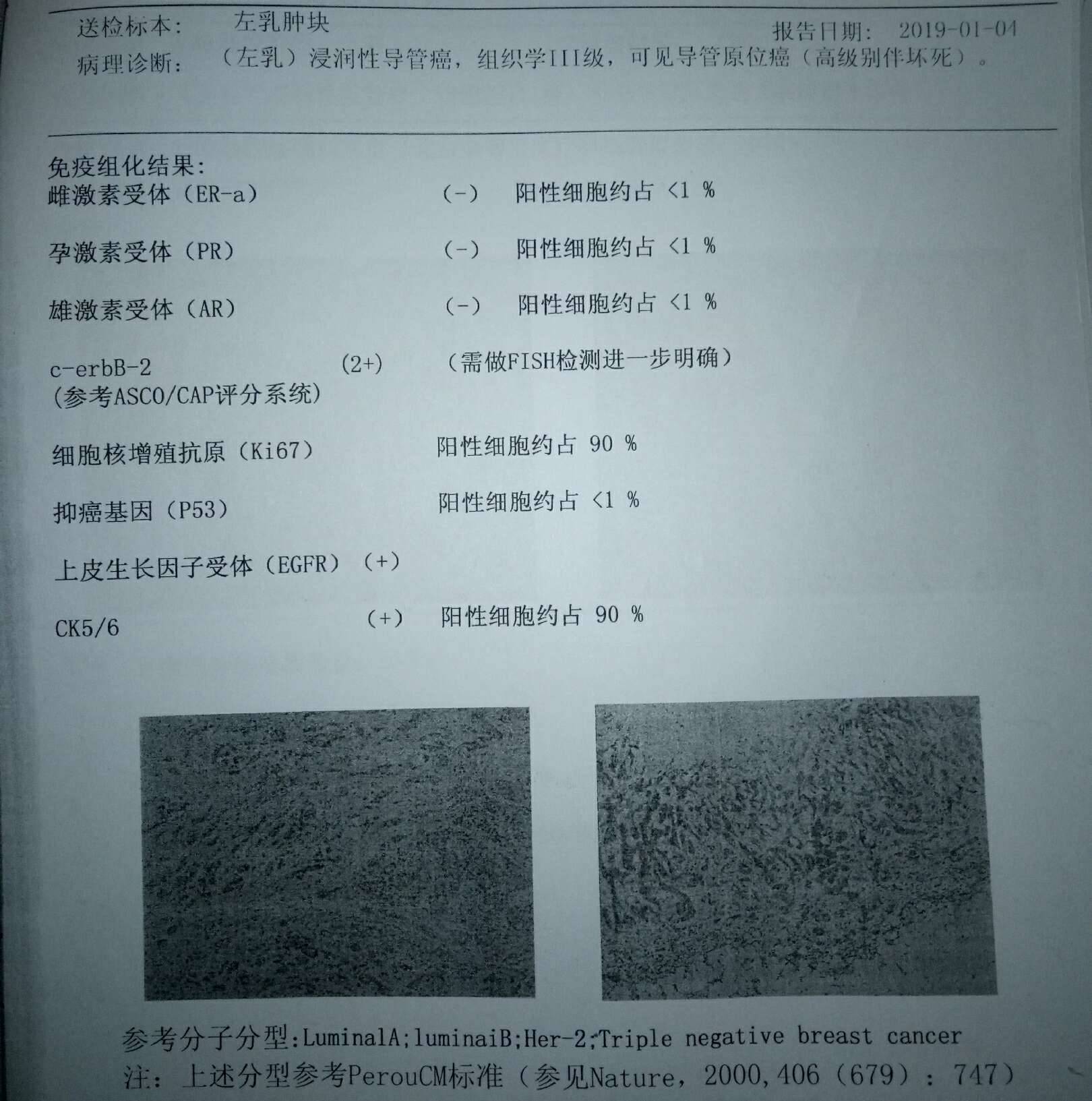 姐妹们帮我看看病理报告吧