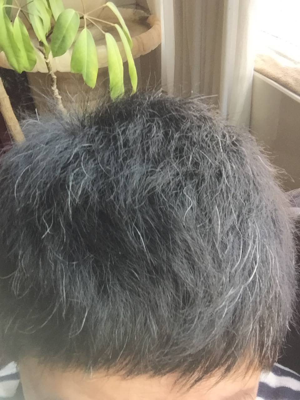 2018年5月18日把头发全剃光之后,整整十个月了,一直不是假发就是帽子