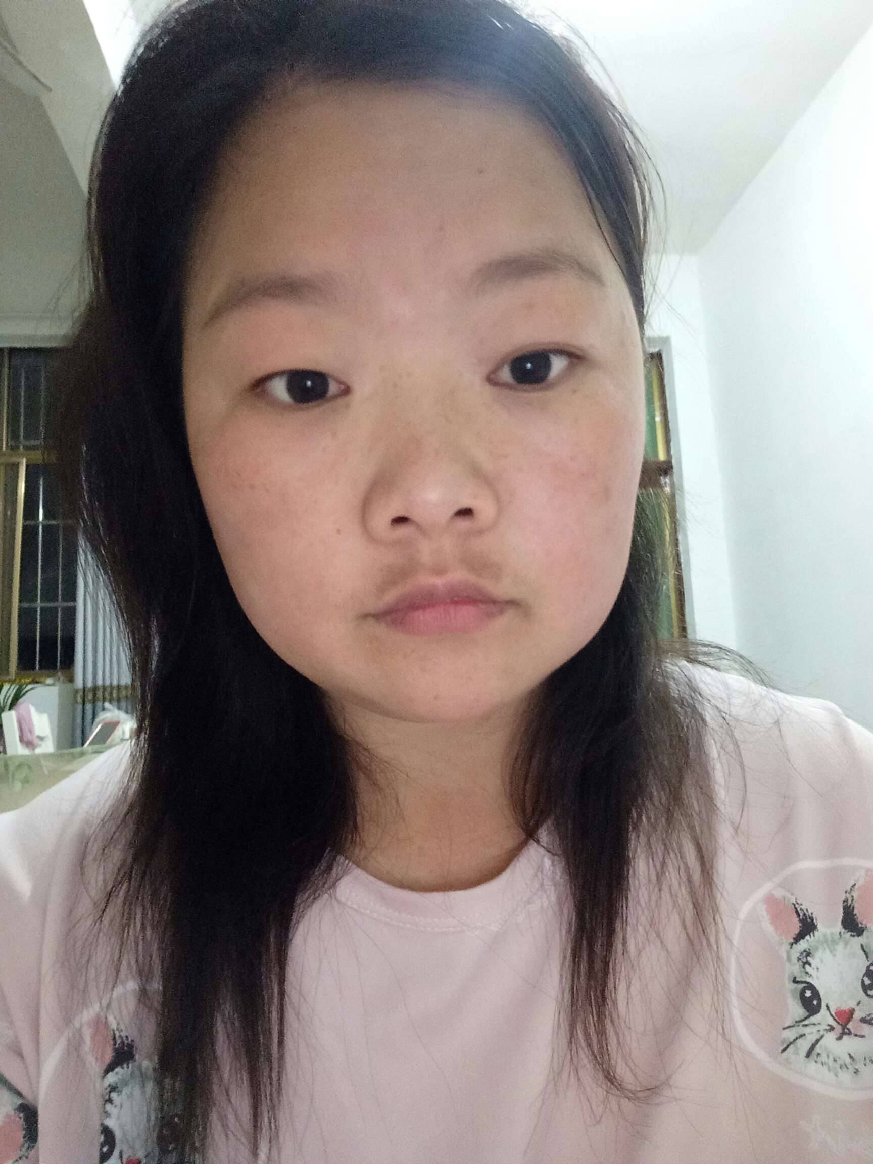 有没有长胡子斑的像