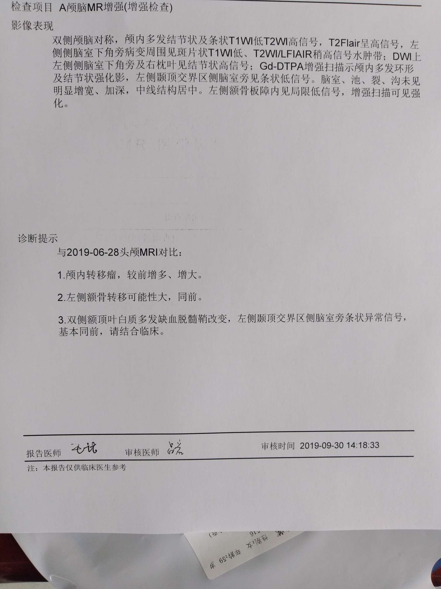 脑部核磁共振报告图片