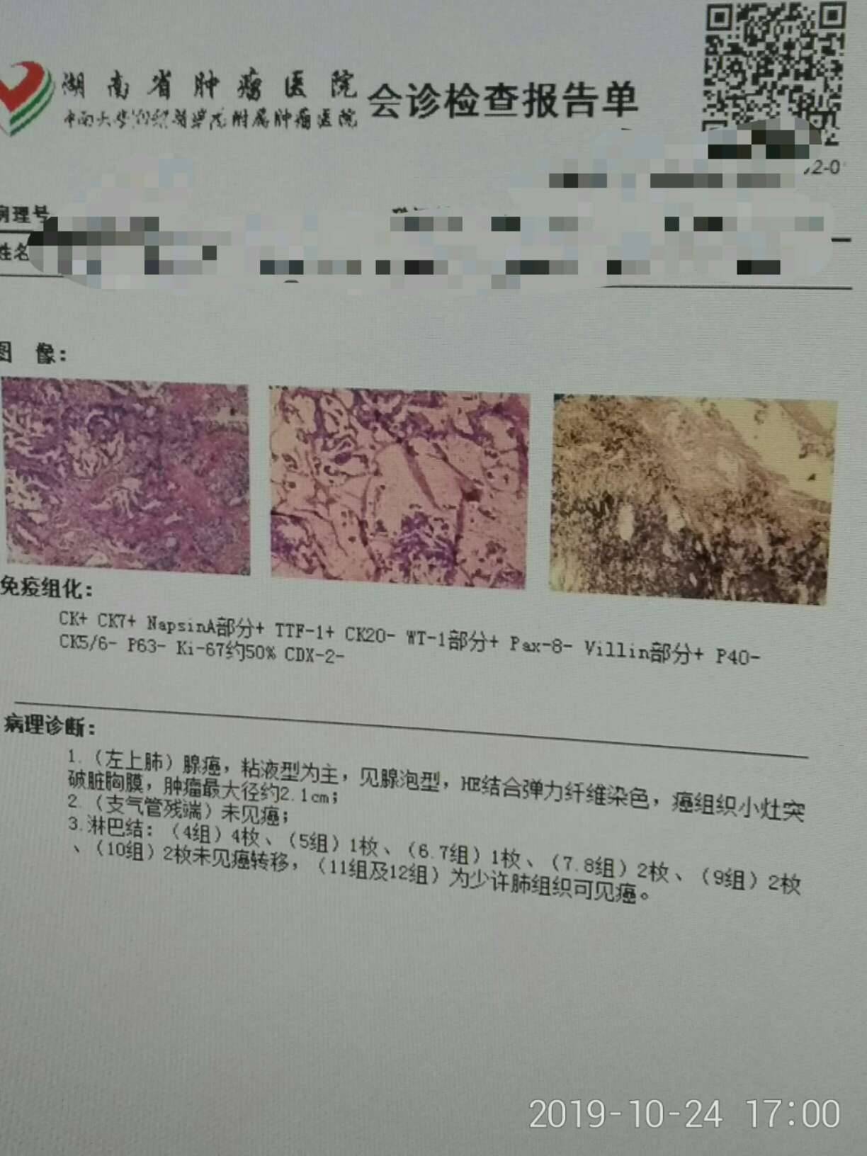 请帮忙看下病理报告