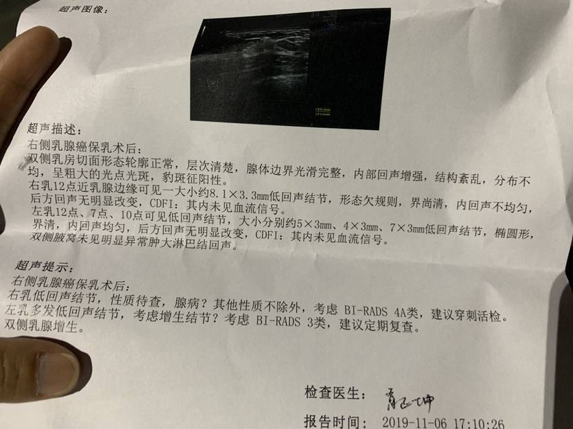又给我判了个4a 心情沉重
