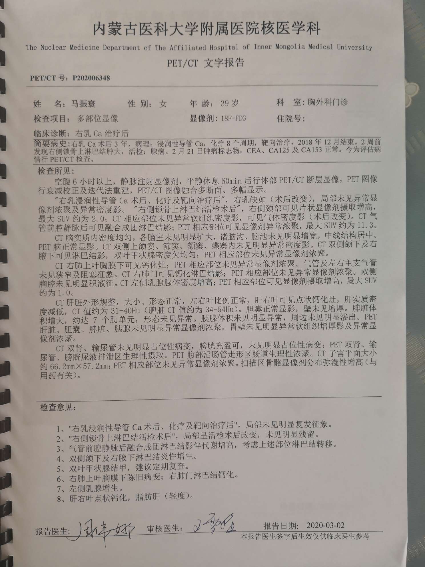 petct结果出来了