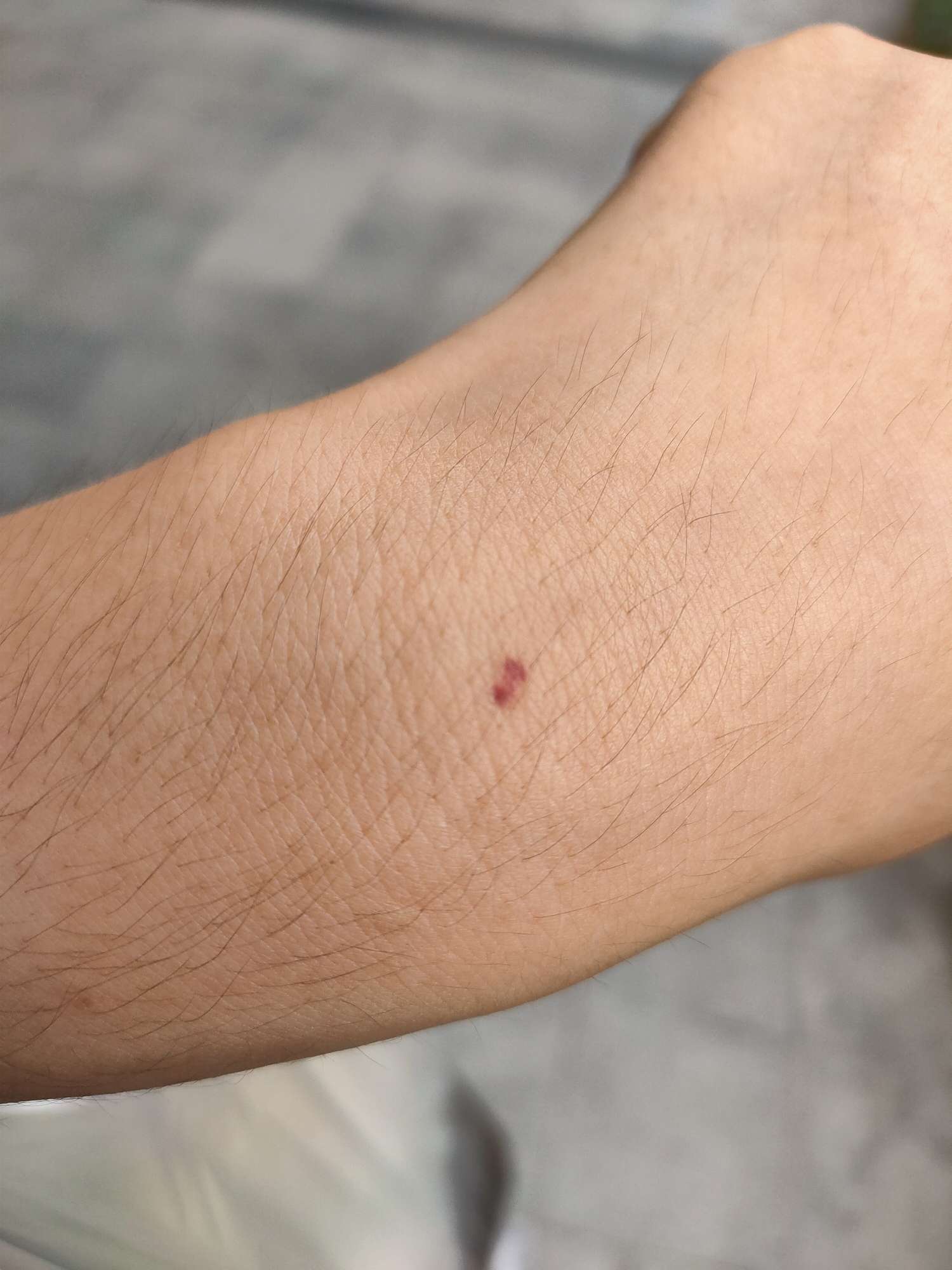 手腕上多了两个血点妈耶这什么鬼0606