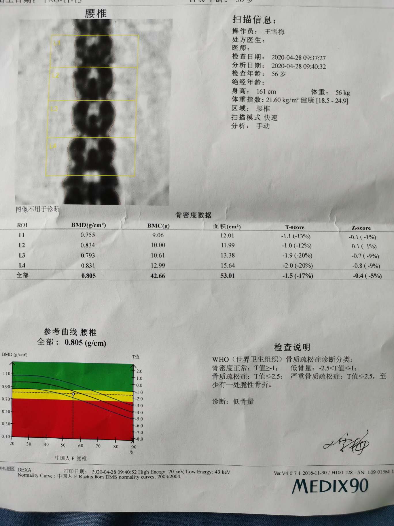 你查过骨密度吗