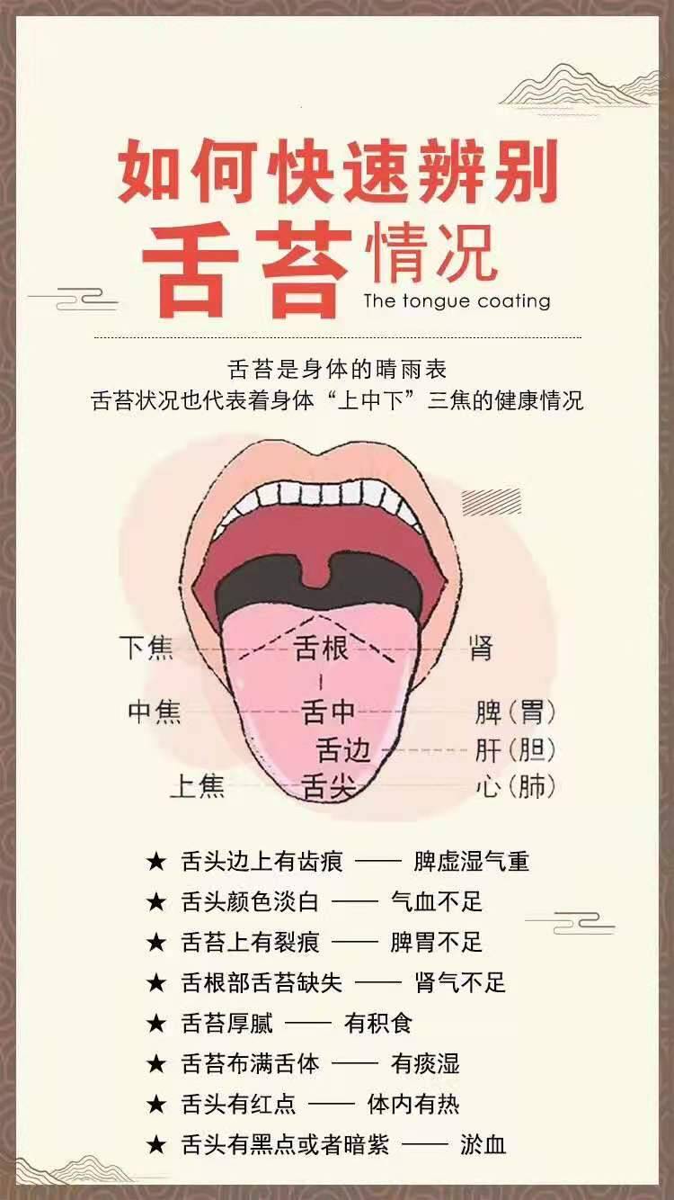 【科普舌苔】舌苔状况代表着人体"上中下"三焦点健康情况.舌