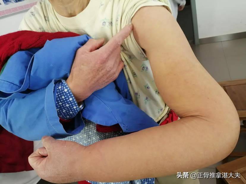 乳腺癌术后水肿按摩图图片