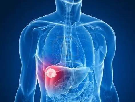 多纳非尼VS索拉非尼治疗肝癌疗效，哪个生存期更长？
