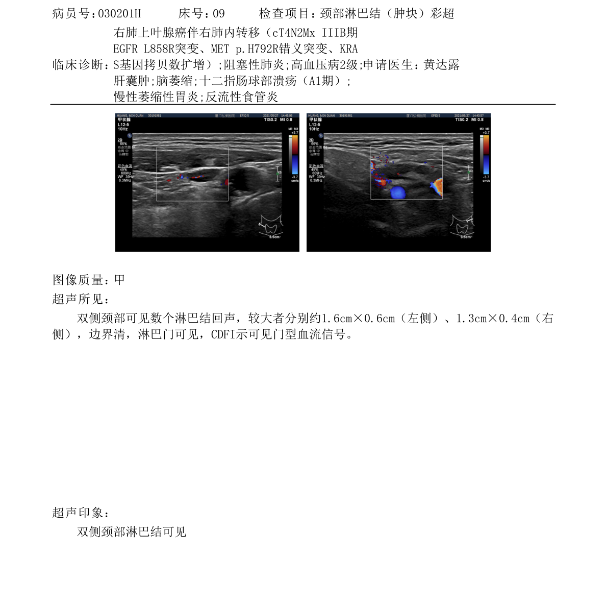 颈部淋巴结变大是不是肺癌转移的迹象？ 我爸爸2020年12月确