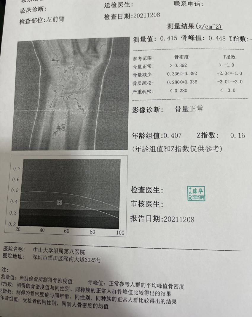 關於骨密度檢查