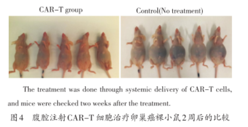 CAR-T细胞疗法获批！卵巢癌患者能用吗？