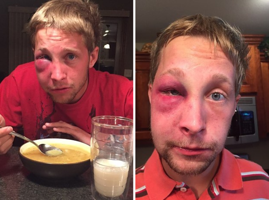 阿斯伯格综合征少年被校园欺凌后想索要的赔偿