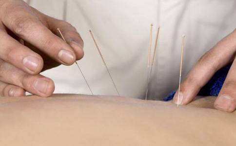 针灸有什么好处 针灸的好处有哪些 针灸的功效与作用
