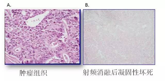 1542796262165088.jpg 640.webp (1).jpg