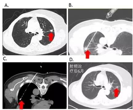 1542796289146233.jpg 640.webp (2).jpg