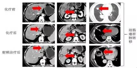 1542796312774904.jpg 640.webp (4).jpg