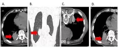 1542796330615783.jpg 640.webp (5).jpg