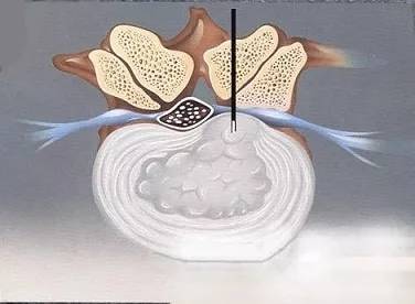 1542796341338127.jpg 640.webp (6).jpg