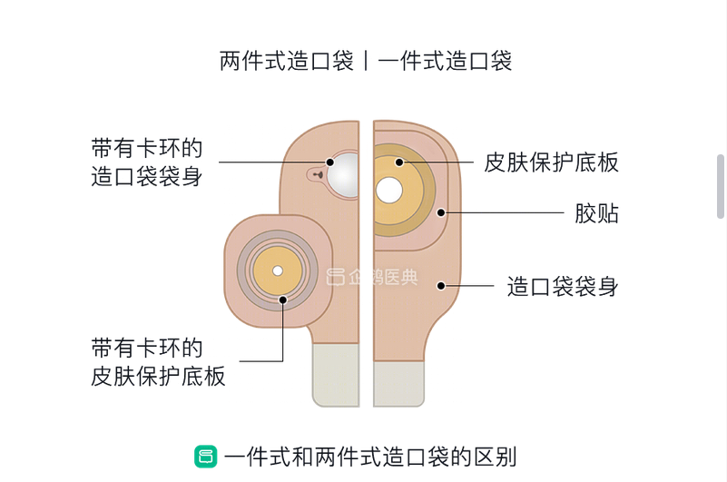 造口袋使用指南