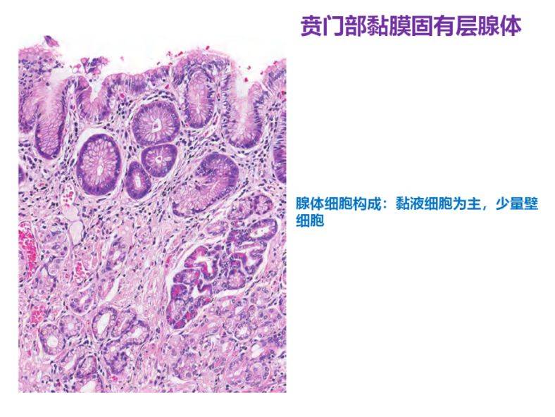 正文根据部位及功能,腺体分为贲门腺,胃体腺(又称胃底腺)和幽门腺三种