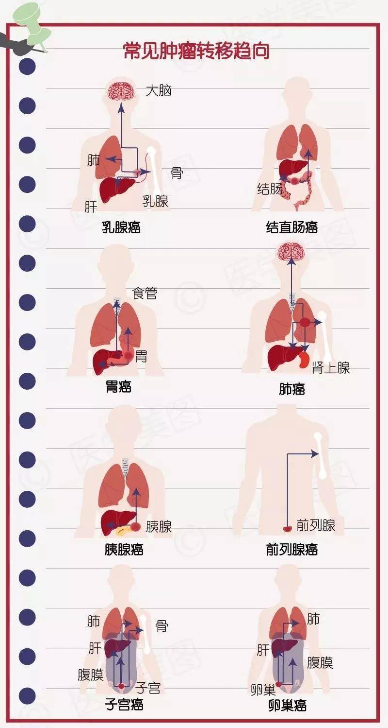 癌症最容易转移至哪些部位