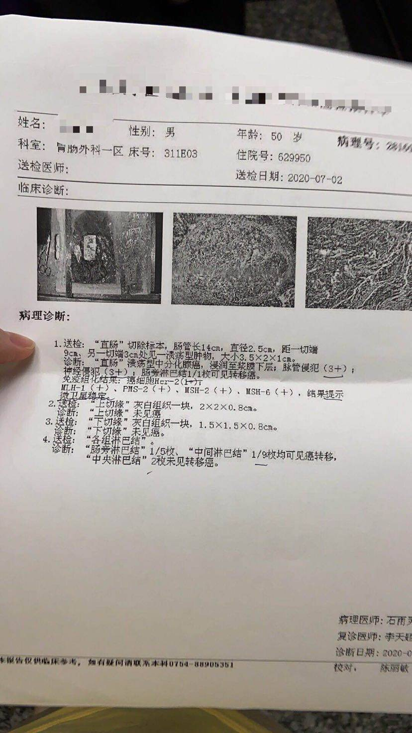 结肠癌活检病理报告图片