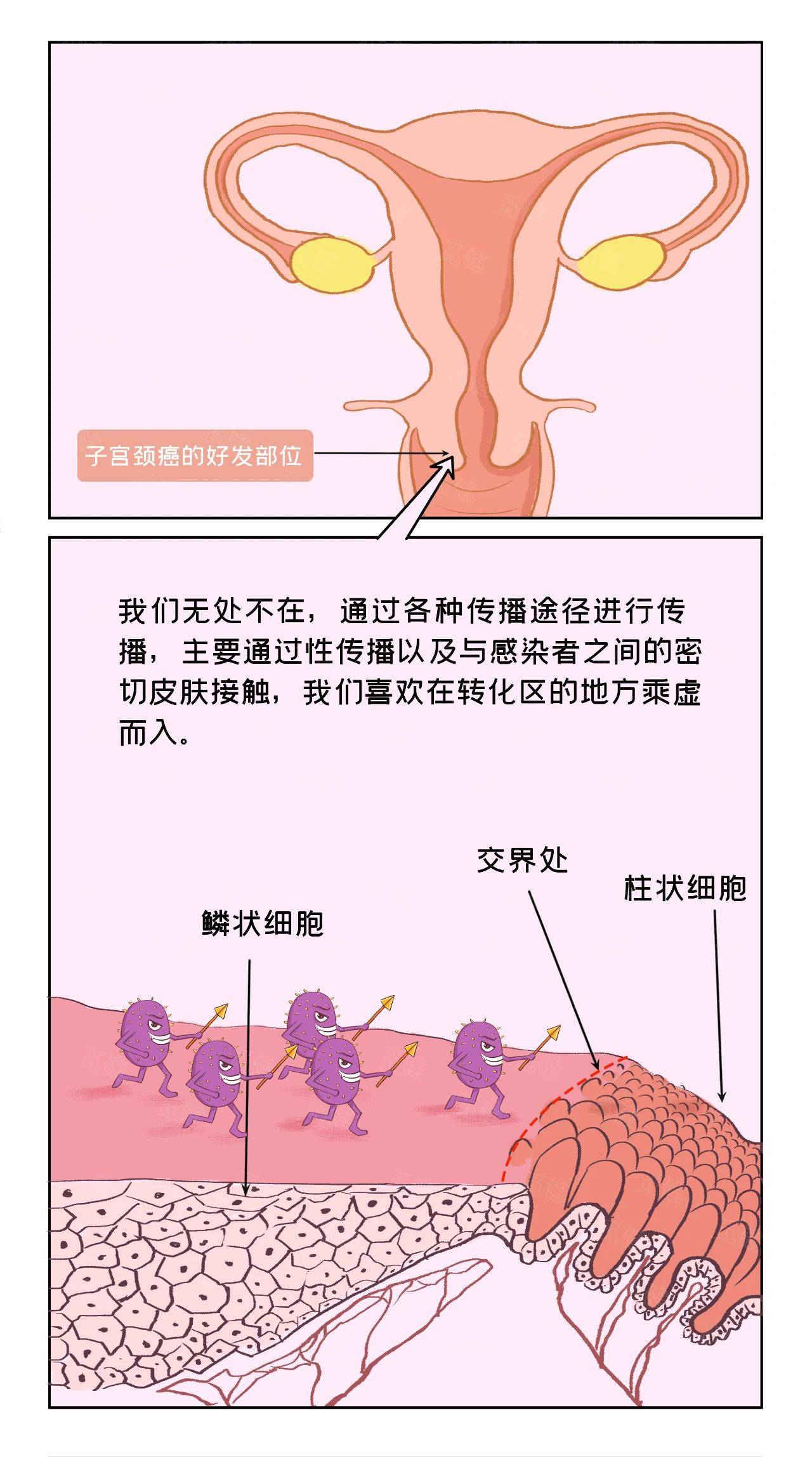 HPV是怎么感染的图片