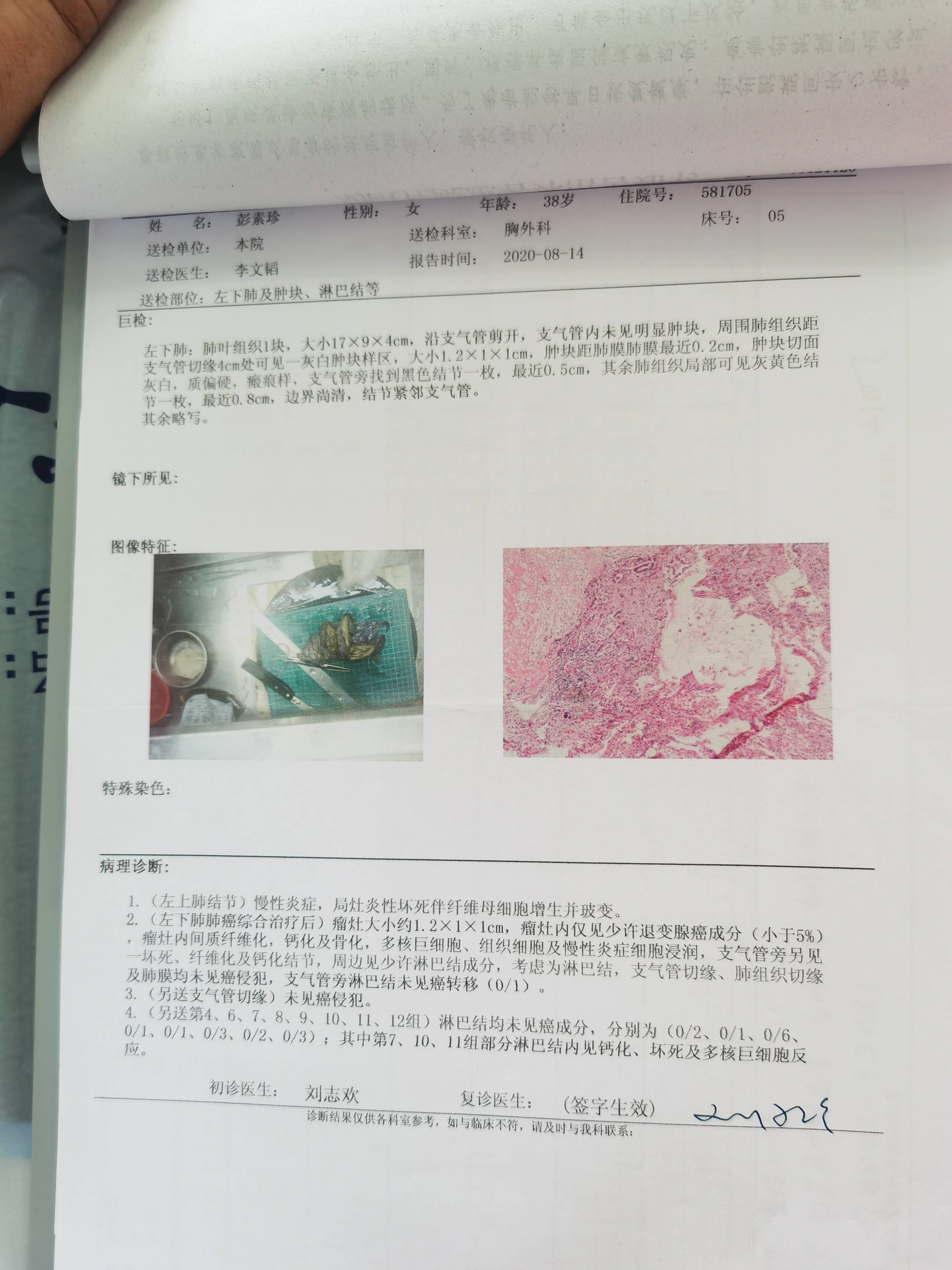 肺癌病理报告 手术图片