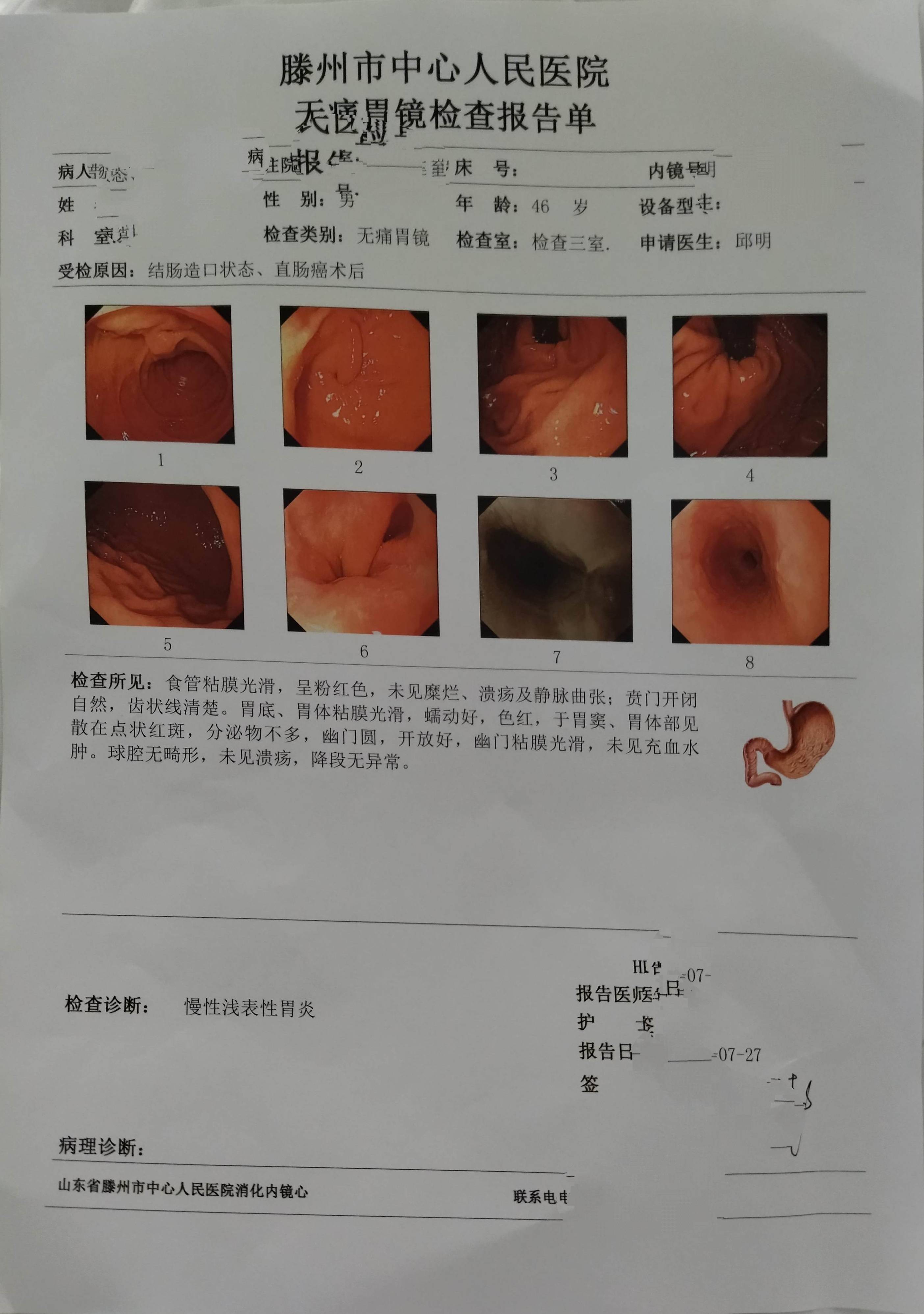 肠镜报告图片怎么看图片