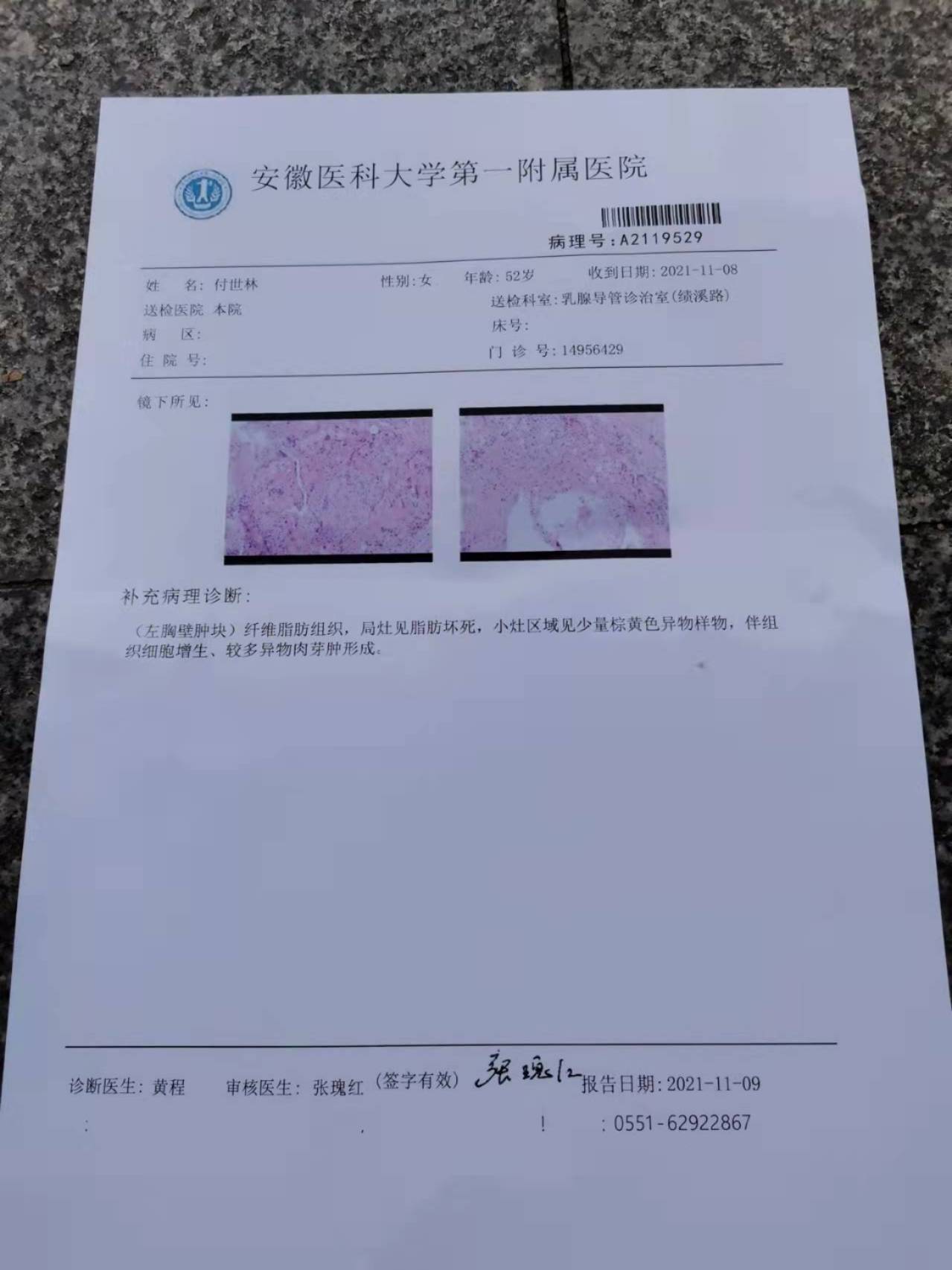 乳腺癌胸壁复发57例图片