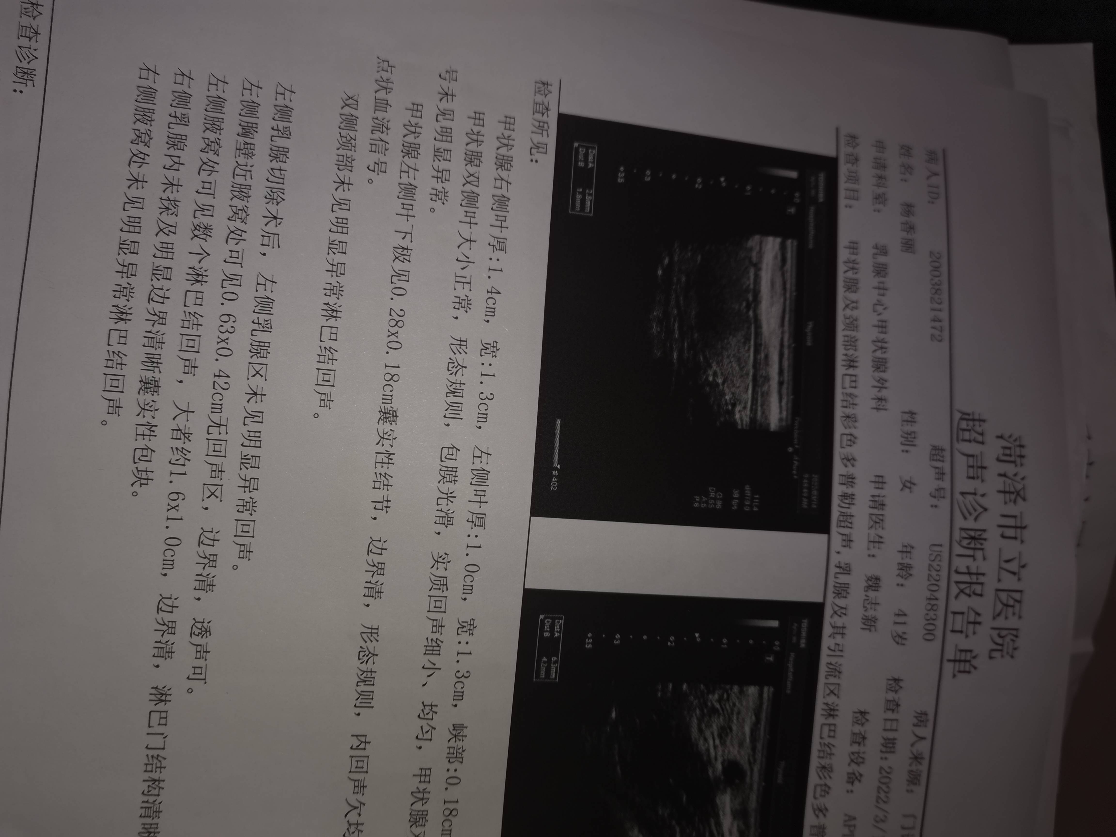 患侧腋窝淋巴结比上次大了一毫米