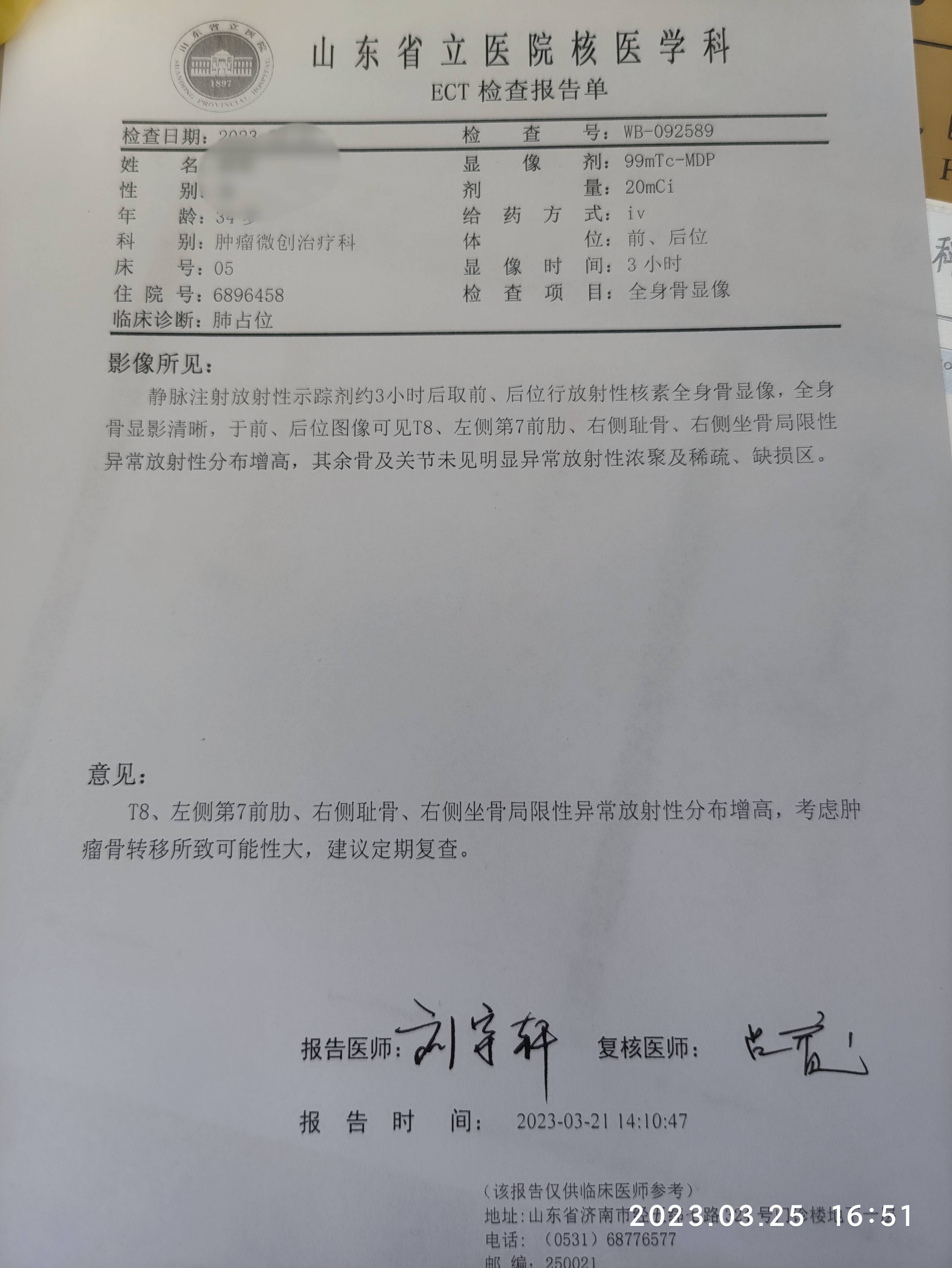 ect检查图片