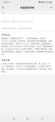 肺腺3a期,alk突变。确诊时右上肺肿块,右下肺小结节,纵隔2R4R区淋