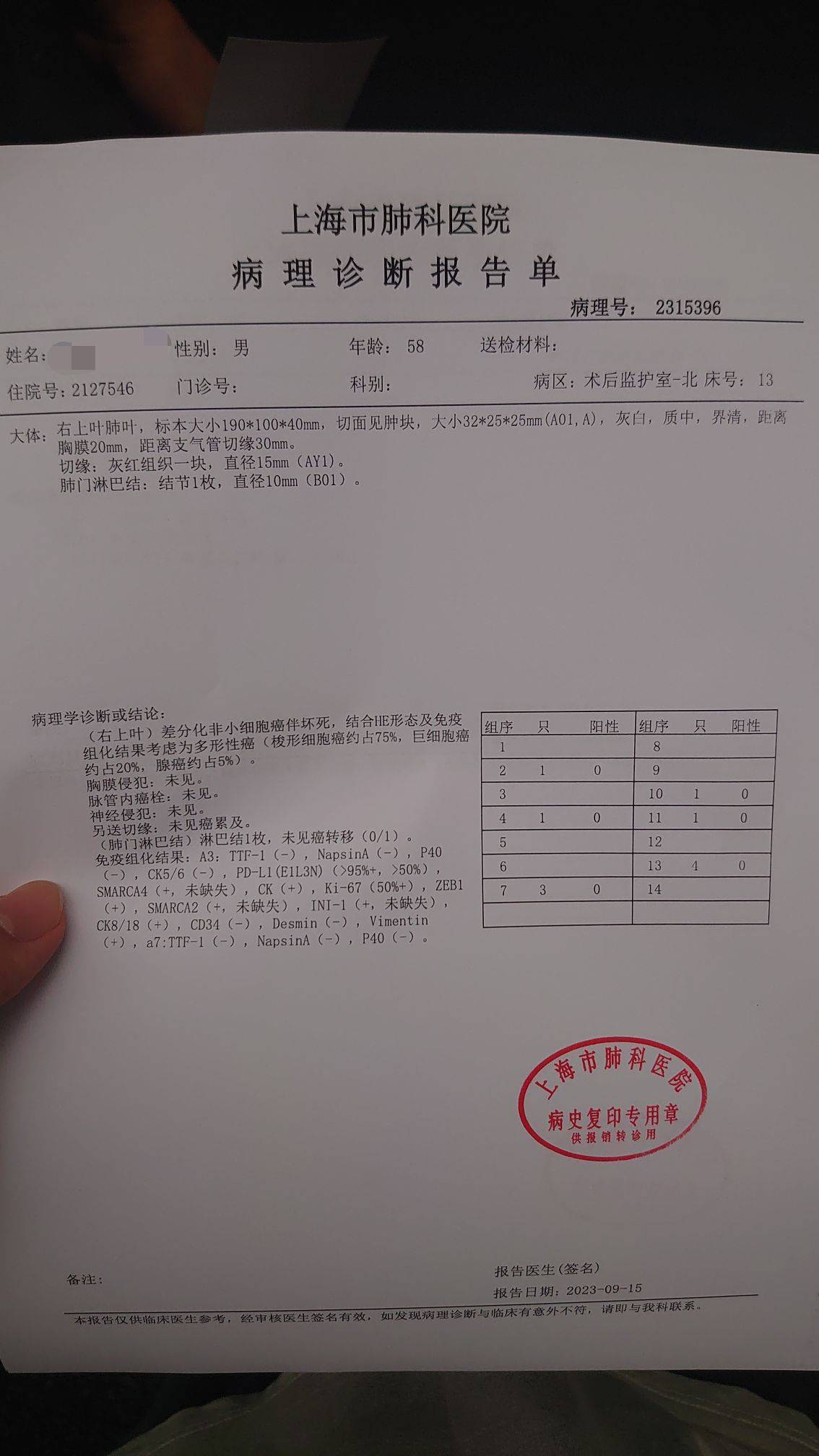 父亲确诊多形性癌