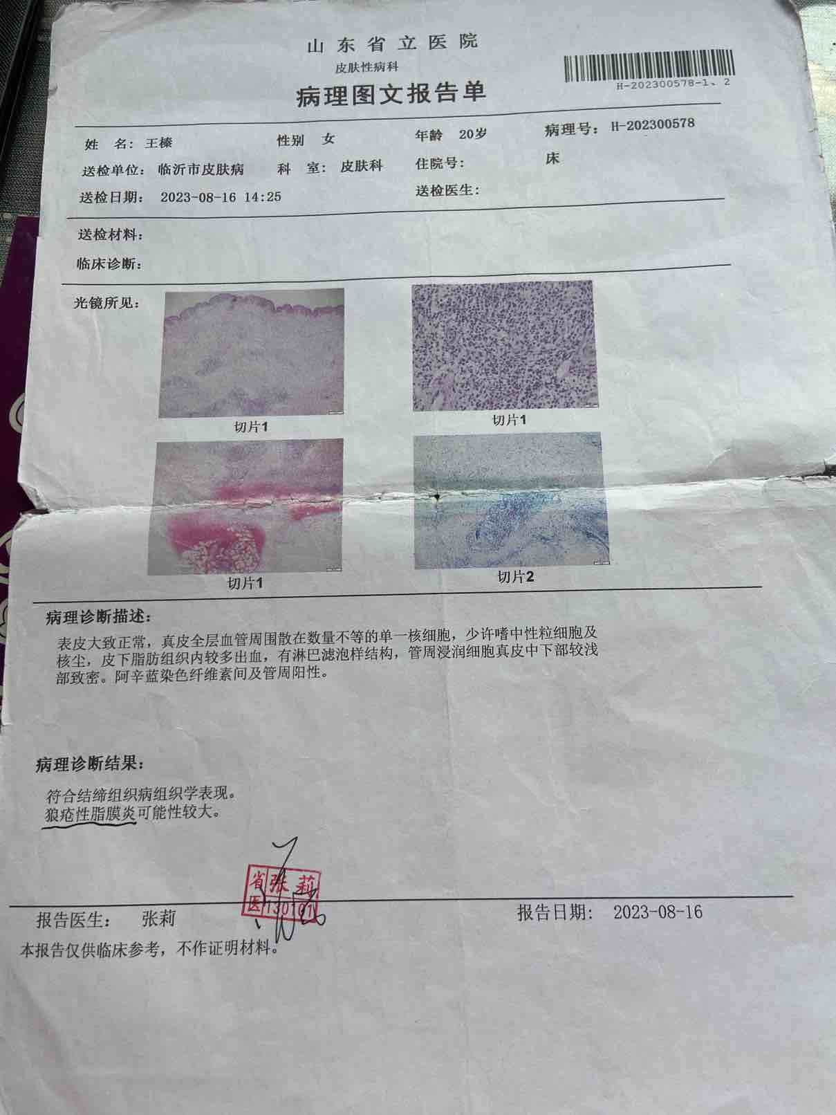 然后上海的医院就说你的炎症指标太高了，建议让我打雅美罗试试打了一针，再去