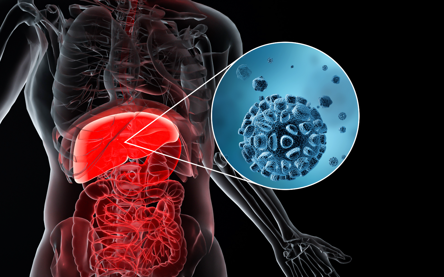 维也纳医科大学发现潜在疗法：阻断分子信号通路逆转肝癌生长
