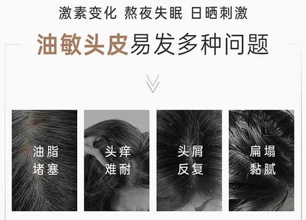 【好物推荐】这款洗发水，温柔解决了我的头皮难题！